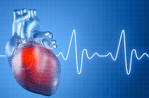 cardiac-management-1-2