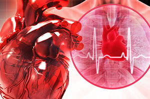 cardiac-management-4-2