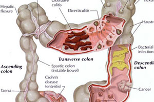 colon-hydro-therapy-3-2