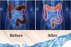 colon-hydro-therapy-4-3